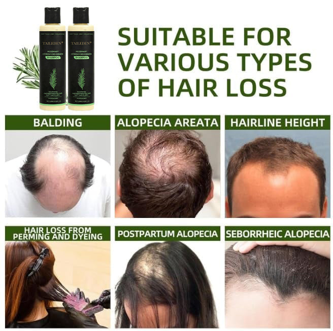 Veraroot™ Rosemary Shampoo