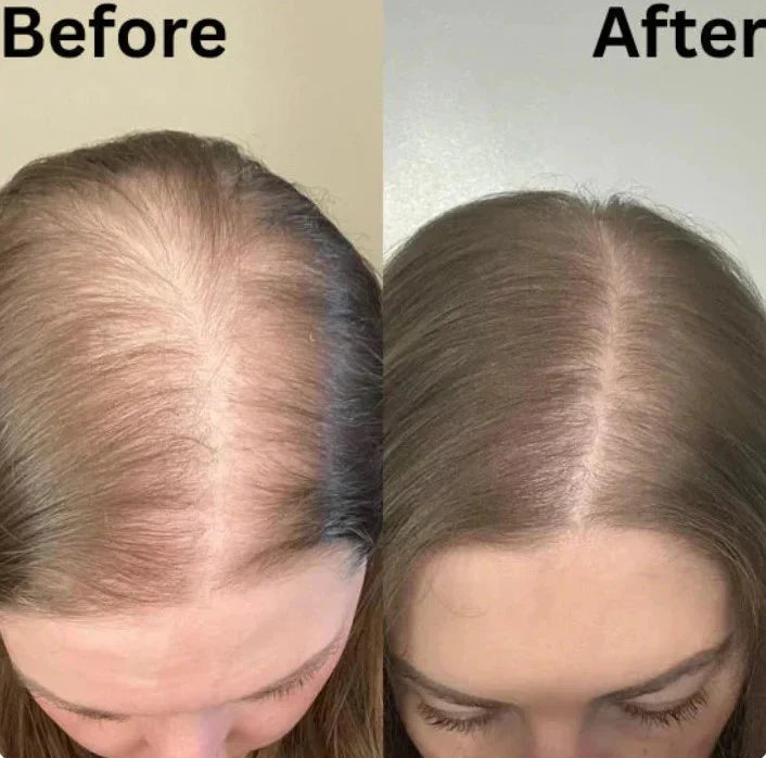 Veraroot™ Rosemary Shampoo