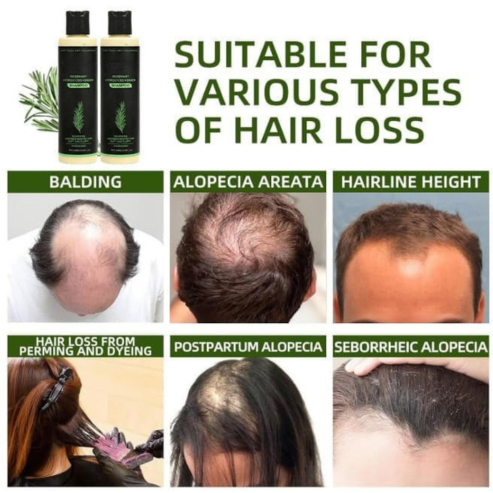 Veraroot™ Rosemary Shampoo